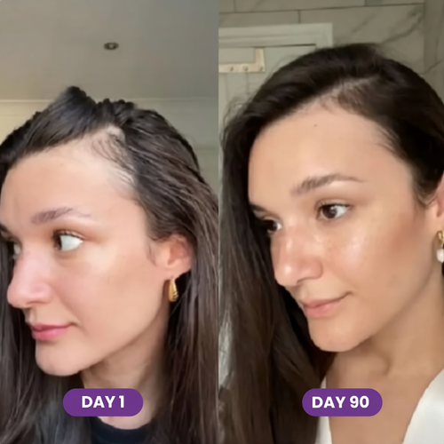 GLP-1 Hair Growth Accelerator Soft Chews