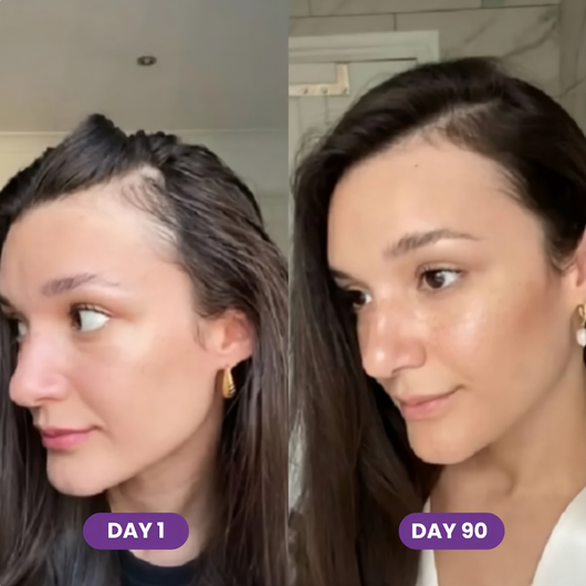 GLP-1 Hair Growth Accelerator Soft Chews