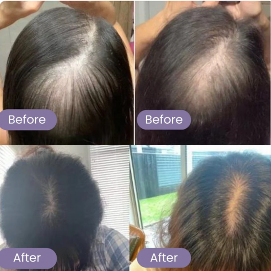 Natural Hair Growth Serum
